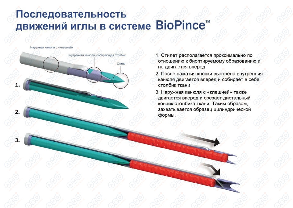 Биопсийный_одноразовый_пистолет_BioPince_11_960_683